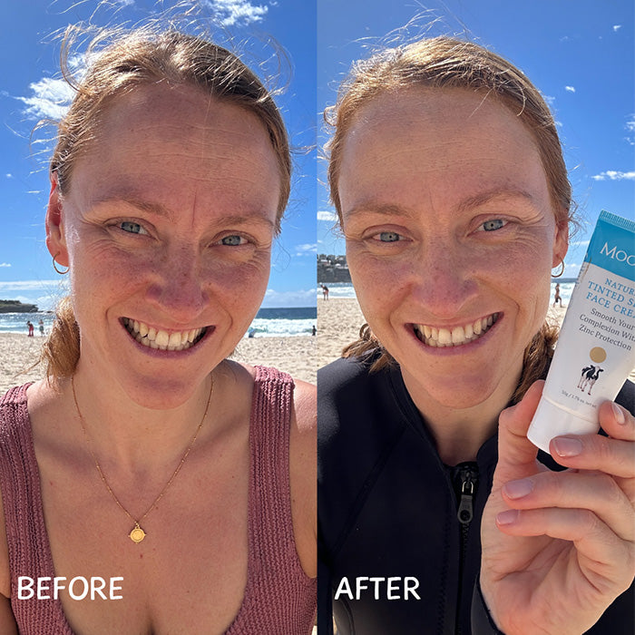 hydrates and reduces redness in sensitive skin.

MooGoo Tinted SPF 40 Face Cream at beach before and after, zinc oxide sunscreen with tint for dewy coverage, UVA UVB protection and skin hydration.